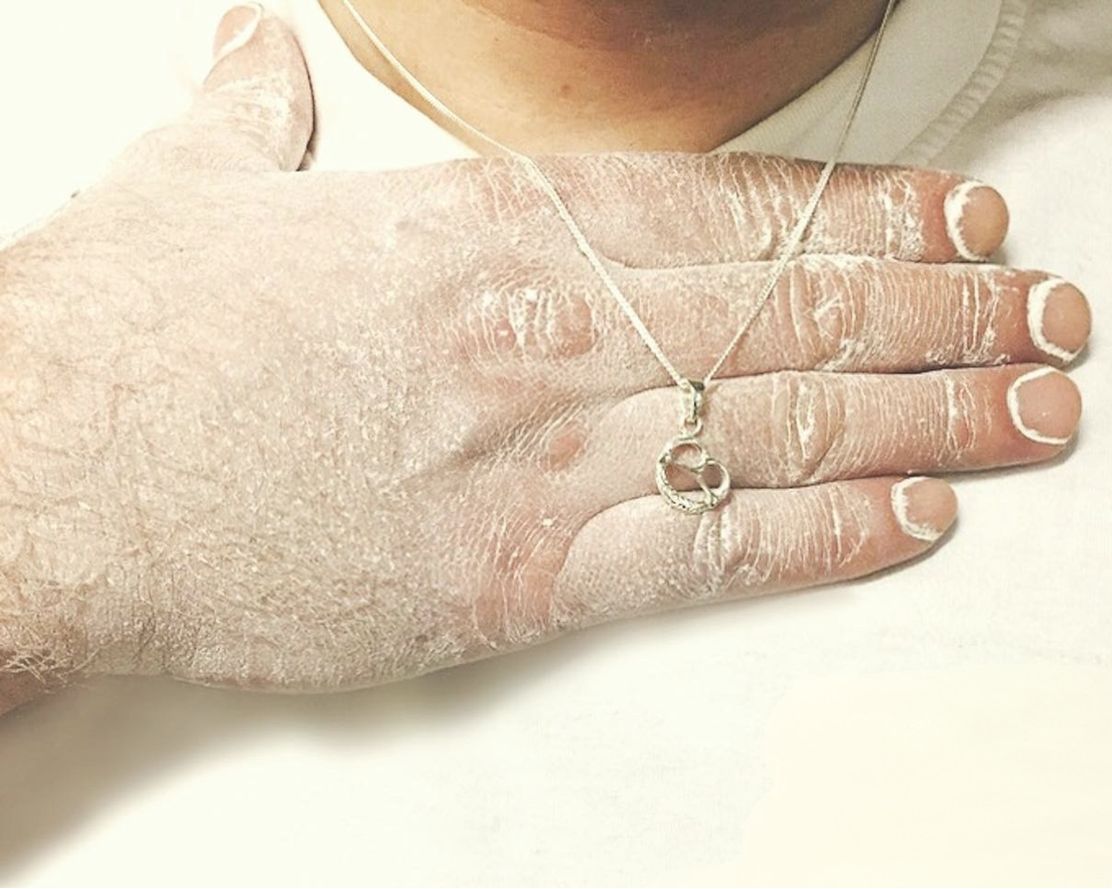 Hand mit Brezelkette